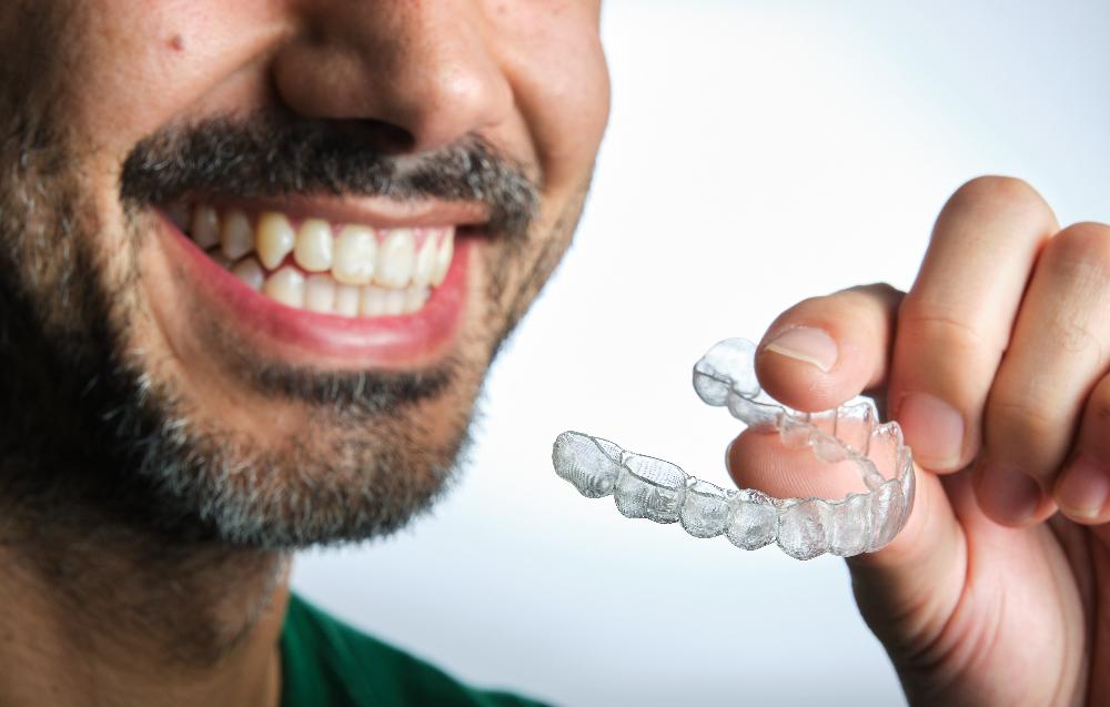 Clear Aligners