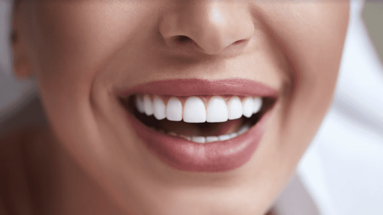 how your smile looks like with porcelain veneers from seymour dental