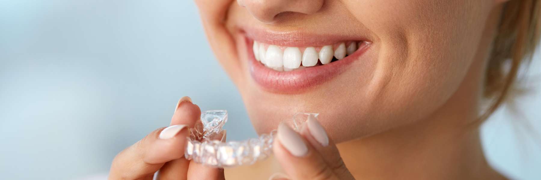 Aligners